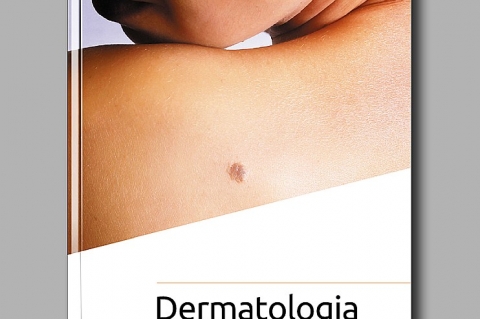 dermadlaniederma